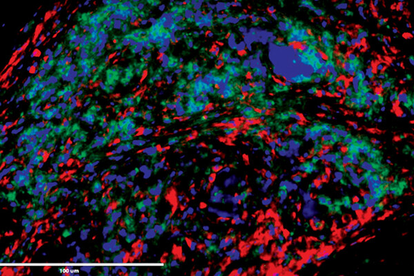 Microscope image of immune cells